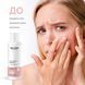 Тонер отшелушивающий для лица RECARE, Exfoliating Face toner, 150 мл 4823109409217 фото 3